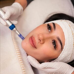 Microneedling - mit Starterset